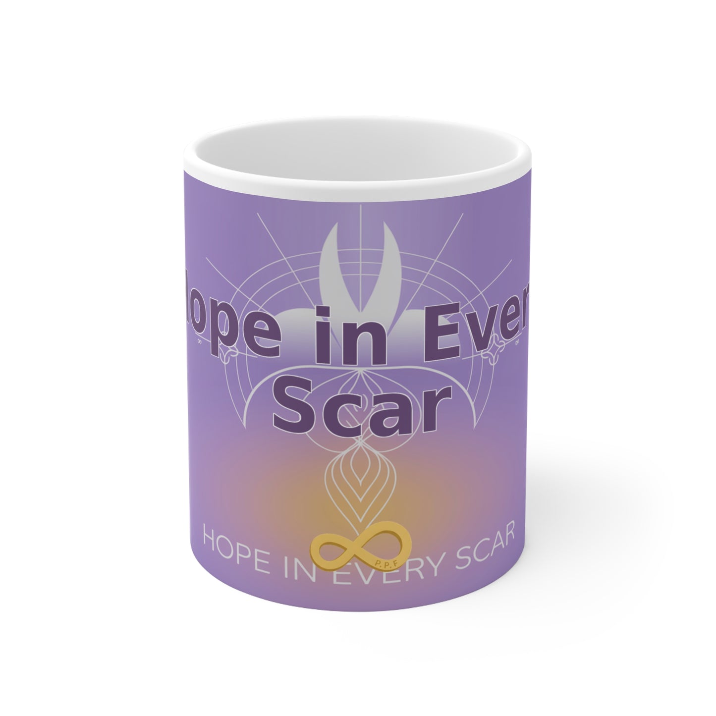 Hope in Every Scar - White Ceramic Mug, 11oz